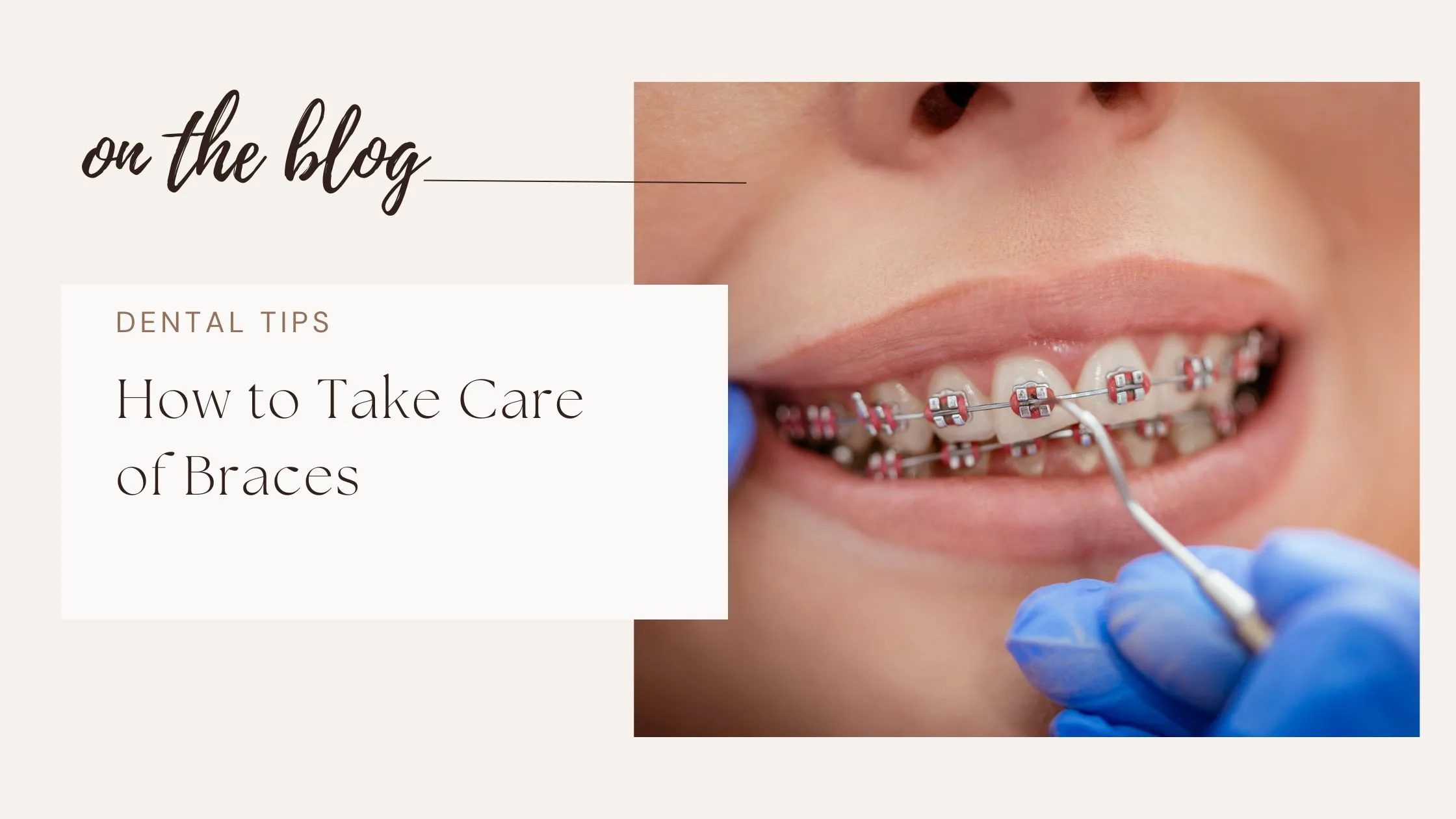 Common Dental Problems